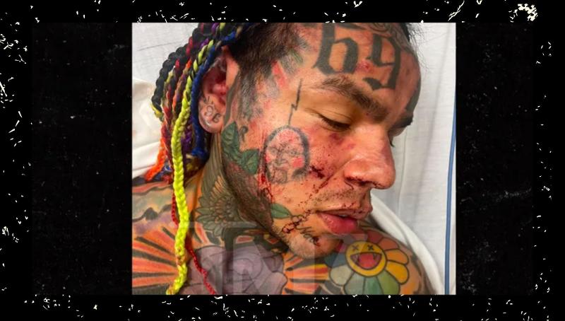 Aggredito brutalmente il rapper 6ix9ine in una sauna in Florida, è grave