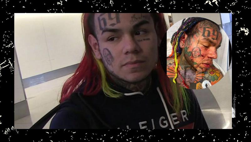 Arrestati gli aggressori di 6ix9ine