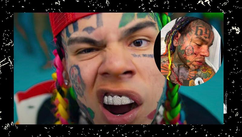 L’ aggressore di 6ix9ine si dichiara non colpevole, ma per l’accusa è il capo di una gang latina